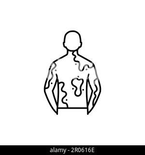 Icona linea nera Vitiligo. Malattie autoimmuni. Pittogramma per pagina web, app mobile, promo. Illustrazione Vettoriale
