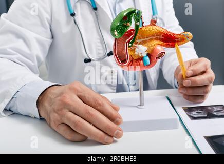 Trattamento di malattie pancreatiche, pancreatite acuta e cronica. medico che mostra malattia pancreatica su modello medico anatomico di pancreas per analys Foto Stock