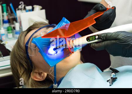 Ripristino della superficie di masticazione con materiale di riempimento in fotopolimero. Dentista che lavora con la lampada UV di polimerizzazione dentale in cavità orale Foto Stock