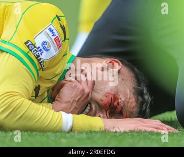 CONTENUTO GRAFICO *** Dimitris Giannoulis #30 di Norwich City riceve un taglio alla guancia durante la partita del campionato Sky Bet Norwich City vs Blackpool a Carrow Road, Norwich, Regno Unito, 8th maggio 2023 (Photo by Alfie Cosgrove/News Images) Foto Stock