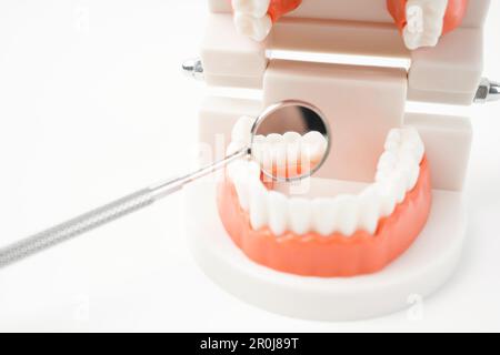 Modello dei denti che mostra un impianto / dimostrazione dentale studio dei denti modello di apprendimento su sfondo bianco. Foto Stock