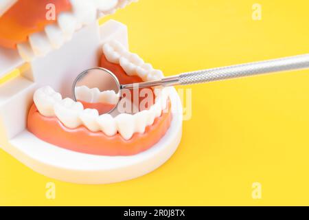 Modello dei denti che mostra un impianto / dimostrazione dentale studio dei denti modello di apprendimento su sfondo giallo. Foto Stock