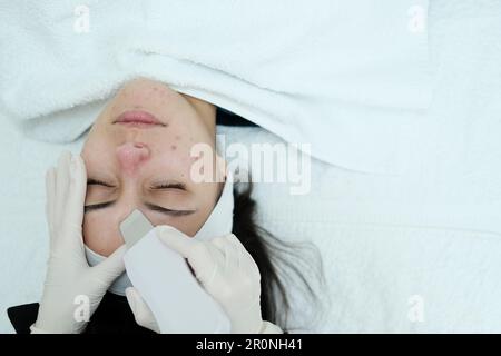 Cosmetologo fare una pulizia profonda del viso con scrubber della pelle Foto Stock