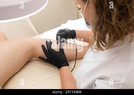 Dermatologist che fa la procedura di elettrolisi di rimozione dei capelli sulla gamba della donna, Shin. Epilazione elettrica nel salone di bellezza. Piano orizzontale. Foto autentica Foto Stock