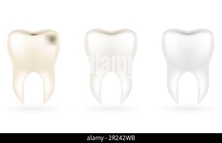 illustrazione del vettore del modello del dente della radice umana isolato su sfondo bianco Illustrazione Vettoriale