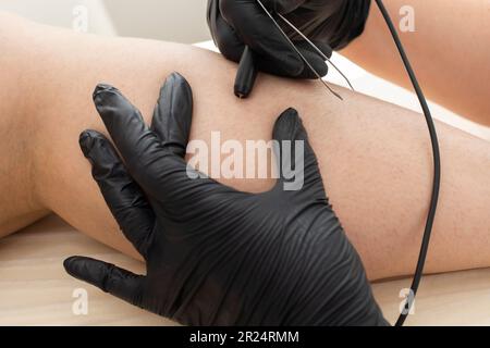 Procedura di elettrolisi di rimozione dei capelli non riconoscibile del dermatologist sulla gamba della donna, Shin. Epilazione elettrica nel salone di bellezza. Piano orizzontale Foto Stock