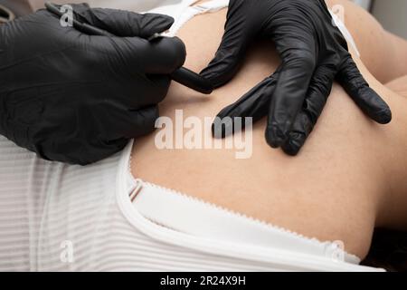 Dermatologist che fa la procedura di elettrolisi di rimozione dei capelli sulla parte posteriore del paziente bianco, epilazione elettrica nel salone di bellezza. Piano orizzontale. Autentico Foto Stock