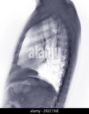 Immagine radiografica o radiografica del torace della vista laterale del polmone umano con inspirazione completa per la rilevazione delle malattie cardiache e polmonari . concetto di check up. Foto Stock