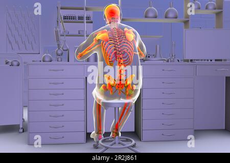 Disturbi muscoloscheletrici negli operatori di laboratorio, illustrazione Foto Stock