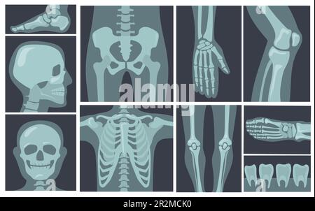 Immagini radiografiche del corpo umano Illustrazione Vettoriale