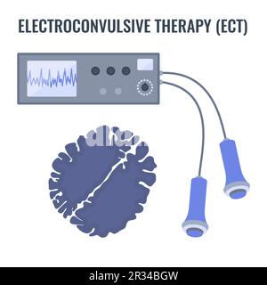 Terapia elettroconvulsiva ECT per il trattamento della depressione grave Illustrazione Vettoriale