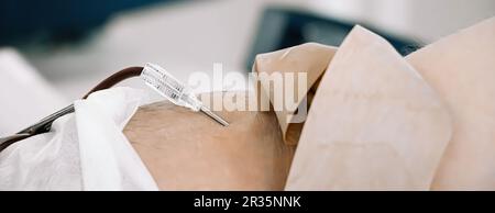 Catetere in primo piano della vena. Giornata internazionale della donazione del sangue. Il donatore dona sangue per salvare la vita. Trasfusione di sangue in laboratorio medico. Formato banner. Foto Stock
