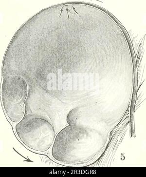 "Malattie dei reni, degli ureteri e della vescica, con particolare riferimento alle malattie delle donne" (1922) Foto Stock