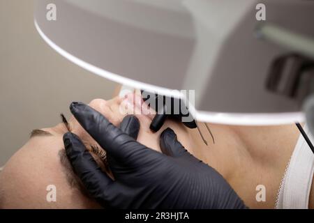 Il cosmetologo rimuove i capelli sopra le labbra sul viso della donna con l'elettrolisi. Elettroepilazione nel salone di bellezza, paziente non riconosciuto. Piano orizzontale Foto Stock