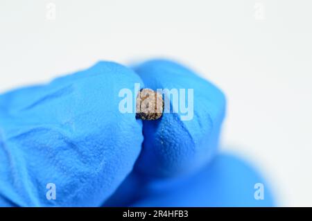 Nefrolitiasi, calcoli renali marroni irregolari (calcoli renali o nefroliti), le dimensioni dei calcoli sono diverse dopo ureteroscopia operativa e laser Foto Stock