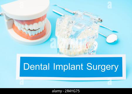 Modelli di denti e strumenti dentali su sfondo blu, concetti di chirurgia implantare dentale Foto Stock