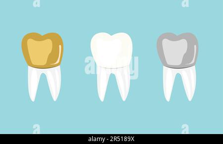 Set di denti molari Oro bianco e Argento Illustrazione Vettoriale