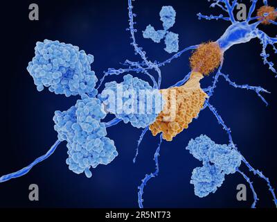 Anticorpo legato ad un peptide beta amiloide, illustrazione Foto Stock