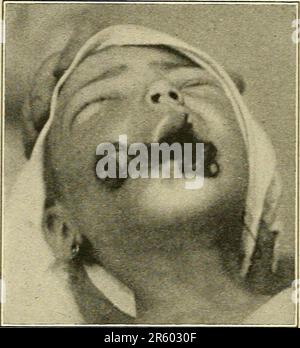 "Malattie dei bambini" (1916) Foto Stock