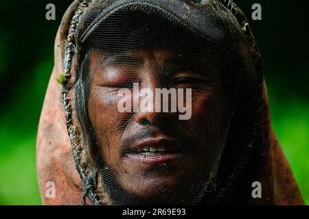 L'occhio sinistro di un cacciatore di miele, Pemba Rinchen è gonfio dopo che le api selvatiche lo hanno colpito mentre stava raccogliendo il miele selvatico. Nelle incantevoli colline del Nepal, si sviluppa una tradizione secolare chiamata caccia al miele, mentre i coraggiosi individui si avventurano nelle insidiose scogliere in cerca del nettare dorato della natura. Con una sola corda come loro linea di vita, questi cacciatori di miele scalano grandi altezze, rischiando la loro vita per la possibilità di raccogliere nido d'ape nascosti nelle altezze. Il comune rurale di Bhotekhosi nel distretto di Sindhupalchowk serve come il loro audace parco giochi. Foto Stock