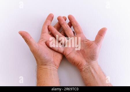 Mani ravvicinate uomo di mezza età, in crepe, rughe, con pelle secca, con calli Foto Stock