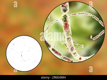 Batteri antrace, micrografia leggera e computer. I batteri antrace (Bacillus antrace) sono la causa della malattia antrace negli esseri umani e. Foto Stock