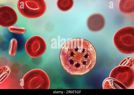 Protozoan Plasmodium malariae all'interno dei globuli rossi, grafica computerizzata. P. malariae è l'agente causativo del Quartan malaria, noto anche come malarico Foto Stock