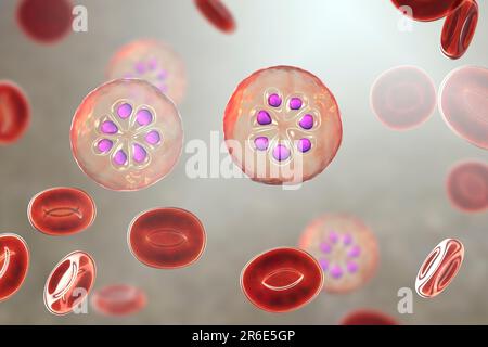 Protozoan Plasmodium malariae all'interno dei globuli rossi, grafica computerizzata. P. malariae è l'agente causativo del Quartan malaria, noto anche come malarico Foto Stock