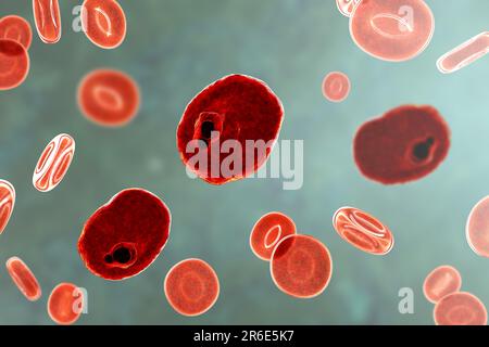 Protozoan Plasmodium ovale all'interno di globuli rossi, computer grafica. P. ovale è l'agente causativo della malaria terzina benigna, nota anche come ovale mal Foto Stock