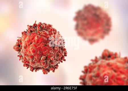Computer illustrazione di un cancro delle cellule bianche del sangue nella leucemia. Foto Stock