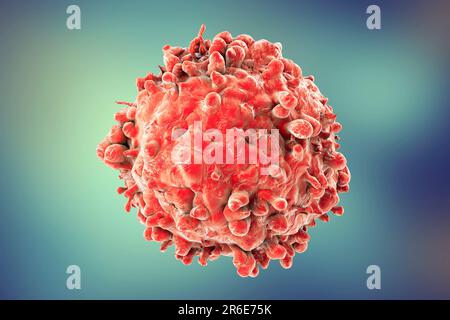 Computer illustrazione di un cancro delle cellule bianche del sangue nella leucemia. Foto Stock