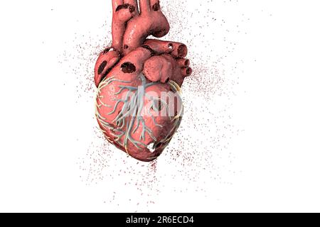 Distruzione del cuore, illustrazione concettuale del calcolatore che può essere usata per illustrare le malattie di cuore. Foto Stock