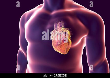 Cuore con vasi coronarici, illustrazione al computer. Foto Stock
