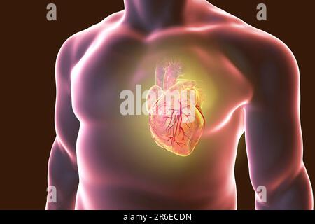 Cuore con vasi coronarici, illustrazione al computer. Foto Stock