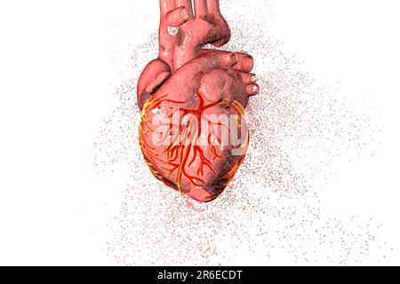 Distruzione del cuore, illustrazione concettuale del calcolatore che può essere usata per illustrare le malattie di cuore. Foto Stock