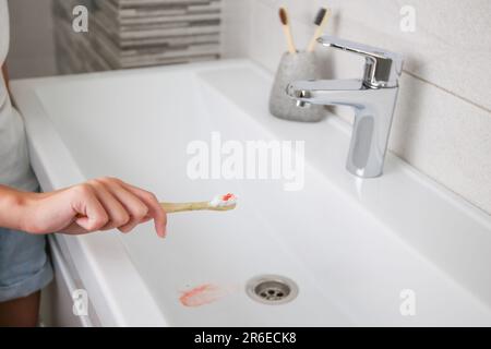 Sangue sullo spazzolino sullo sfondo del lavandino. Messa a fuoco selettiva sullo spazzolino. Foto Stock