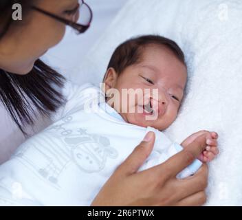 Neonato, palato spinato e cura dei genitori per un bambino felice in un letto a casa con un sorriso in una camera da letto o centro medico. Salute, assistenza sanitaria e bambino Foto Stock