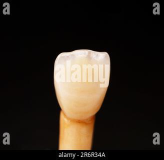 Ceramici finiti corone anteriori, uno sfondo nero Foto Stock