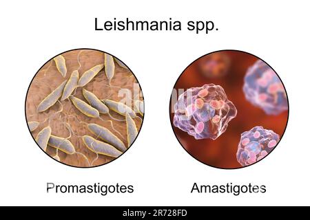 Promastigotes e amastigotes amastigotes di Leishmania parassiti all'interno di macrofagi, opere d'arte. Leishmania sp. causa leishmaniosi, una malattia tropicale Foto Stock