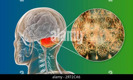 Neuroni del cervelletto umano e del Purkinje, illustrazione. Cervello umano con cervelletto evidenziato e vista ravvicinata dei neuroni Purkinje, uno dei commoni Foto Stock