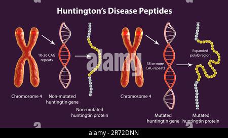Genesi molecolare del morbo di Huntington, 3D. Sequenza proteica Huntingtin sana e mutante con espansione di poliglutammina (polyQ), compu Foto Stock