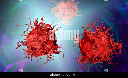 Cellula di cancro della pelle, illustrazione del calcolatore. Foto Stock