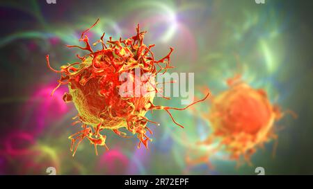 Cellula di cancro della pelle, illustrazione del calcolatore. Foto Stock