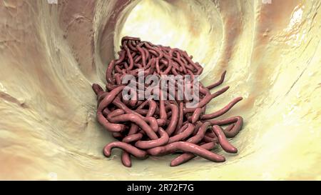 Worm rotondi nell'intestino umano, computer artwork. I vermi rotonde, o nematodi, comprendono numerose specie di vita libera e patogeniche. Nematodi che comune Foto Stock