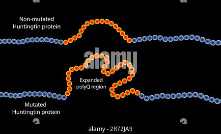 Sequenza proteica Huntingtin sana e mutante, illustrazione al computer. L'espansione della sequenza trinucleotidica CAG nel gene htt causa la produzione di o Foto Stock
