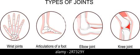 Tipi di giunti. Classificazione biomeccanica e anatomica. Imposta icone con gomito umano, ginocchio, articolazioni del polso e articolazioni di un piede. ossa e j Illustrazione Vettoriale