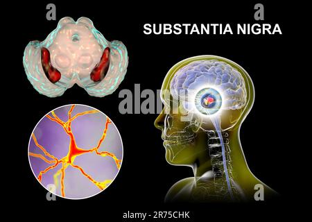 Substantia nigra. Computer illustrazione che mostra un sano substantia nigra del cervello di un uomo e di una vista ravvicinata di neuroni dopaminergici trovati nella Foto Stock