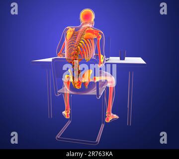 Lavorare con il computer portatile in una posizione errata. Concetto di mal di schiena. Illustrazione del computer che mostra un corpo umano maschio che funziona in una posizione errata. Foto Stock