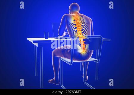 Lavorare con il computer portatile in una posizione errata. Concetto di mal di schiena. Illustrazione del computer che mostra un corpo umano maschio che funziona in una posizione errata. Foto Stock