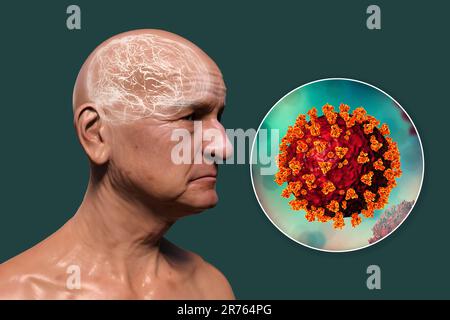 Covid-19 e demenza. Sequele neuropsichiatriche di Covid-19, illustrazione concettuale del computer. Eziologia infettiva della demenza. Una persona anziana con spirito Foto Stock